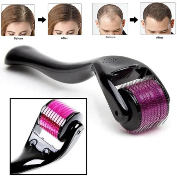 derma-roller-titanium-micro-needle-drs-540-pins-derma-roller-stainless-steel-for-facial-skin-care-hair-loss-treatment-tool-3_1727331614.webp