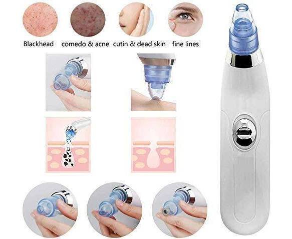 derma-suction-blackheads-remover-device-blackhead-extractor-2-5_1726839450.jpg