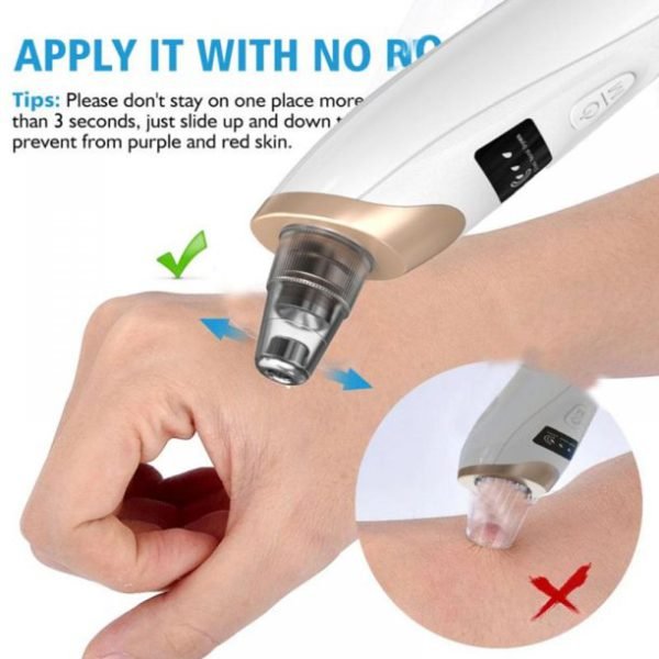 electric-suction-blackhead-instrument-home-beauty-instrument-blackhead-pore-cleaning-7-4_1727602109.jpg